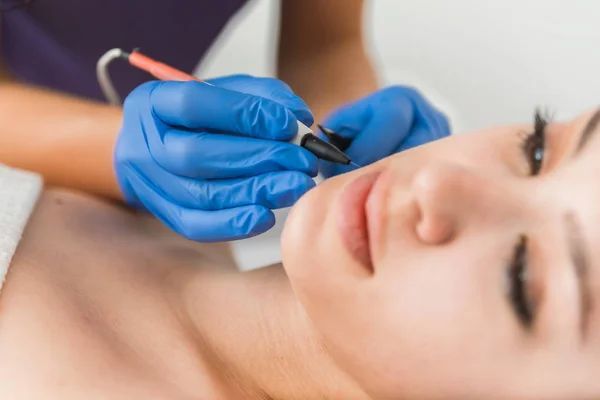 A woman is getting electrolysis on her face.
