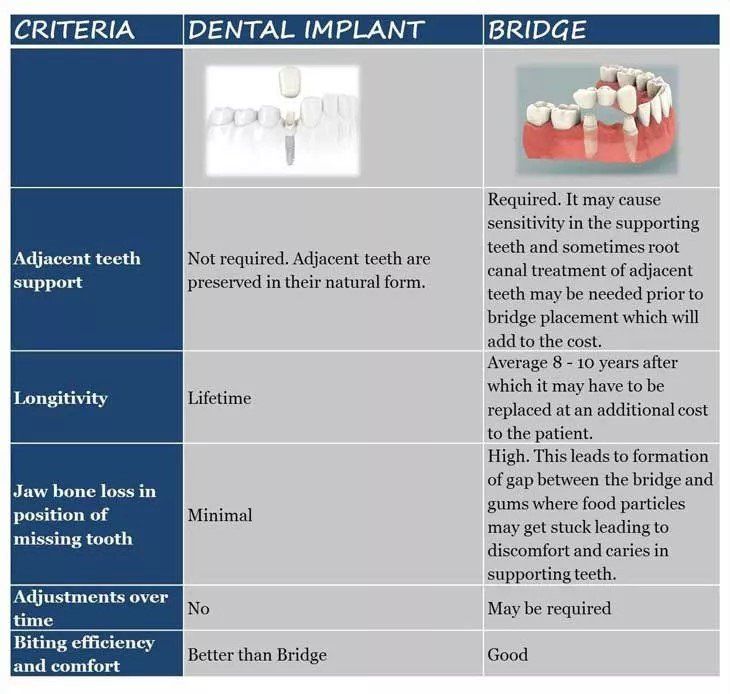 implants vs bridge bullet points
