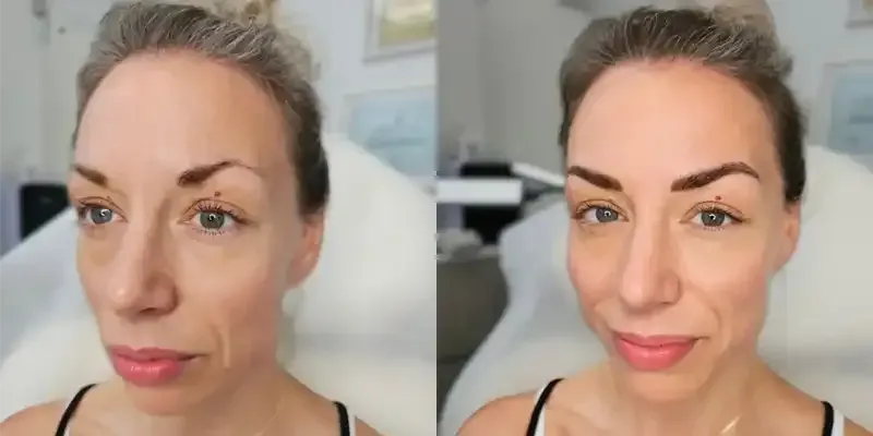 A before and after photo of a woman 's face with and without makeup.