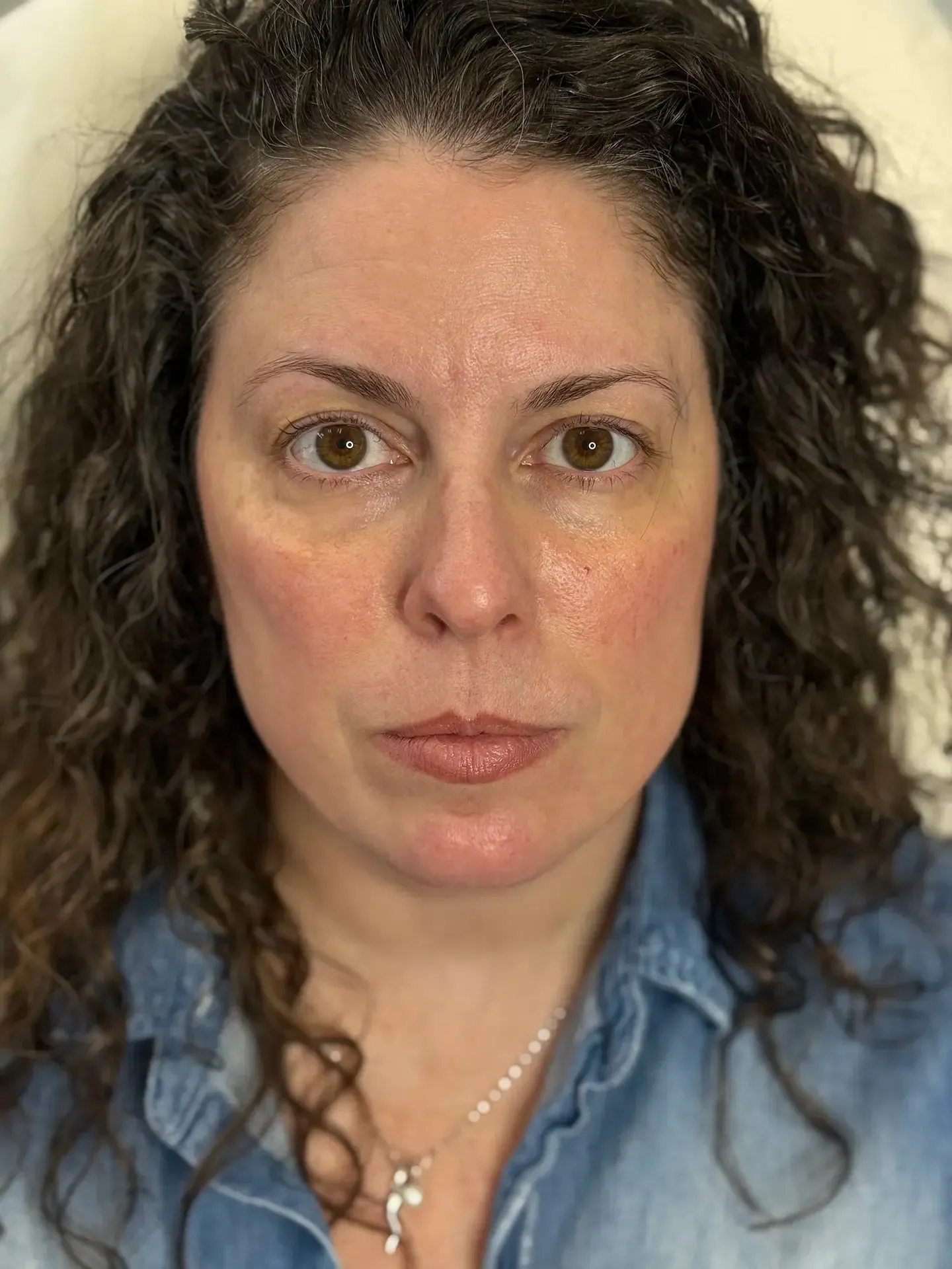 A woman with curly brown hair and a denim shirt after treatment