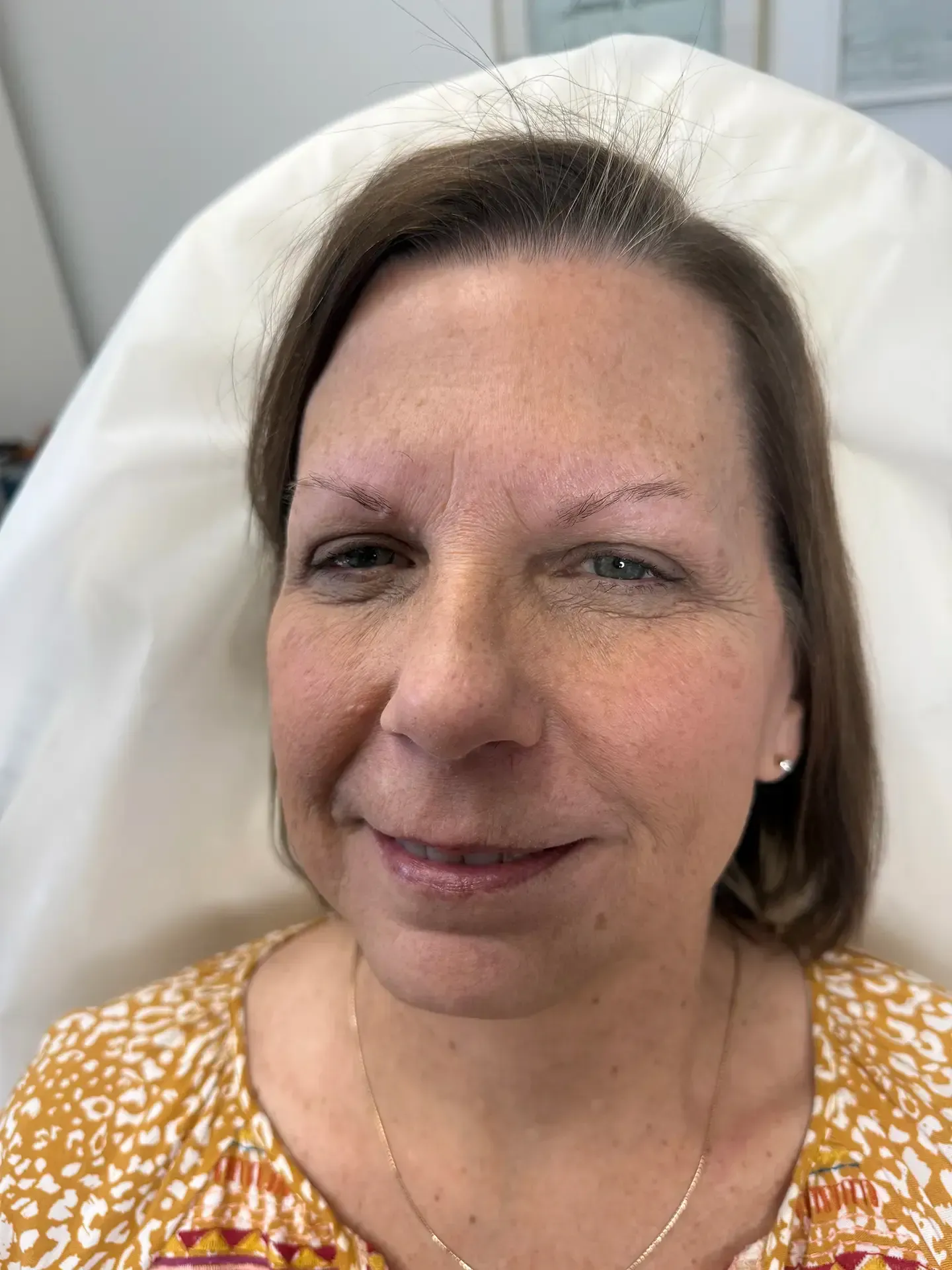 Woman with sparse eyebrows, ready for nano strokes service.