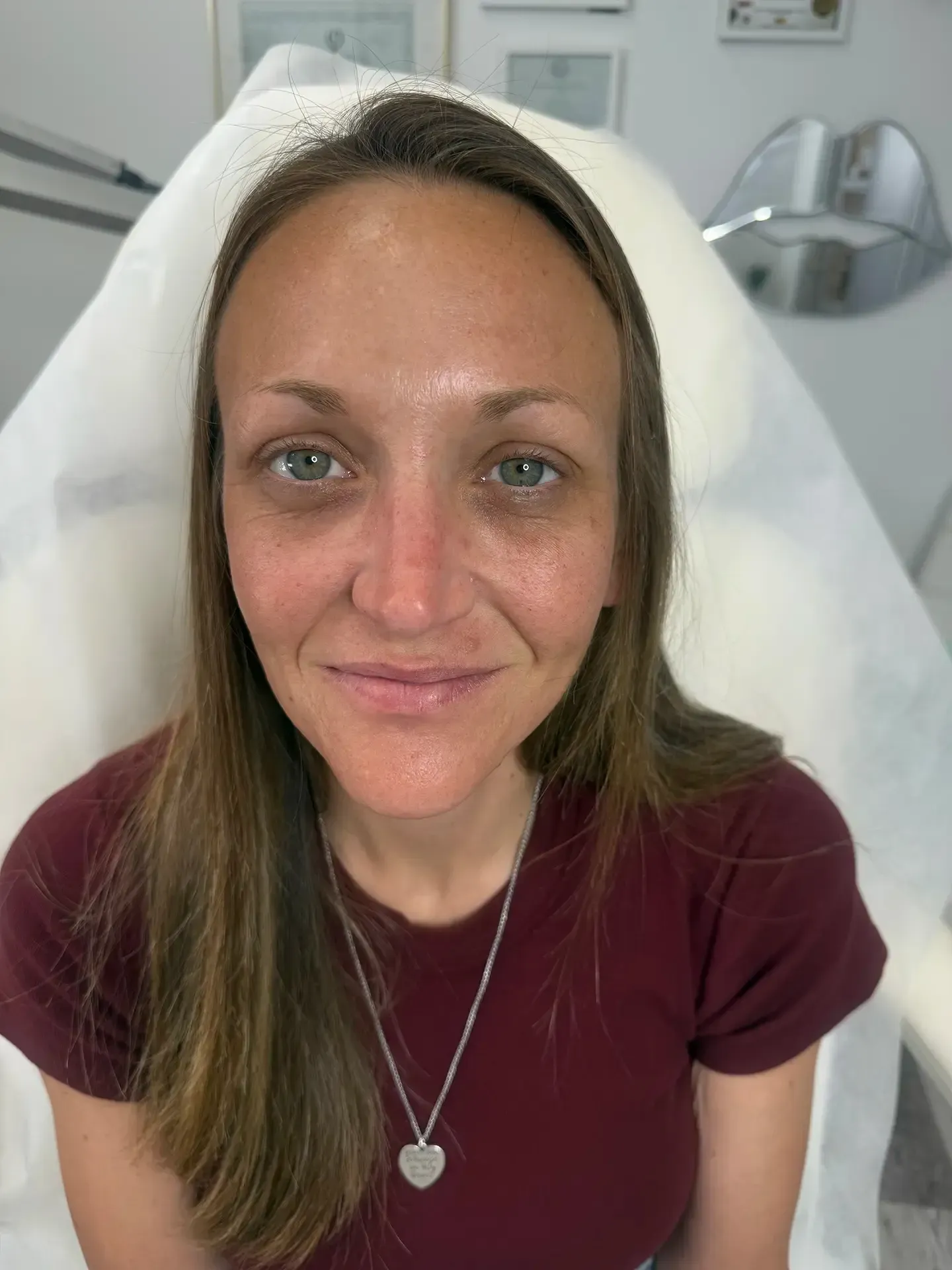 Woman with fair skin and long brown hair, wearing a maroon shirt and silver necklace, sitting in a medical setting.