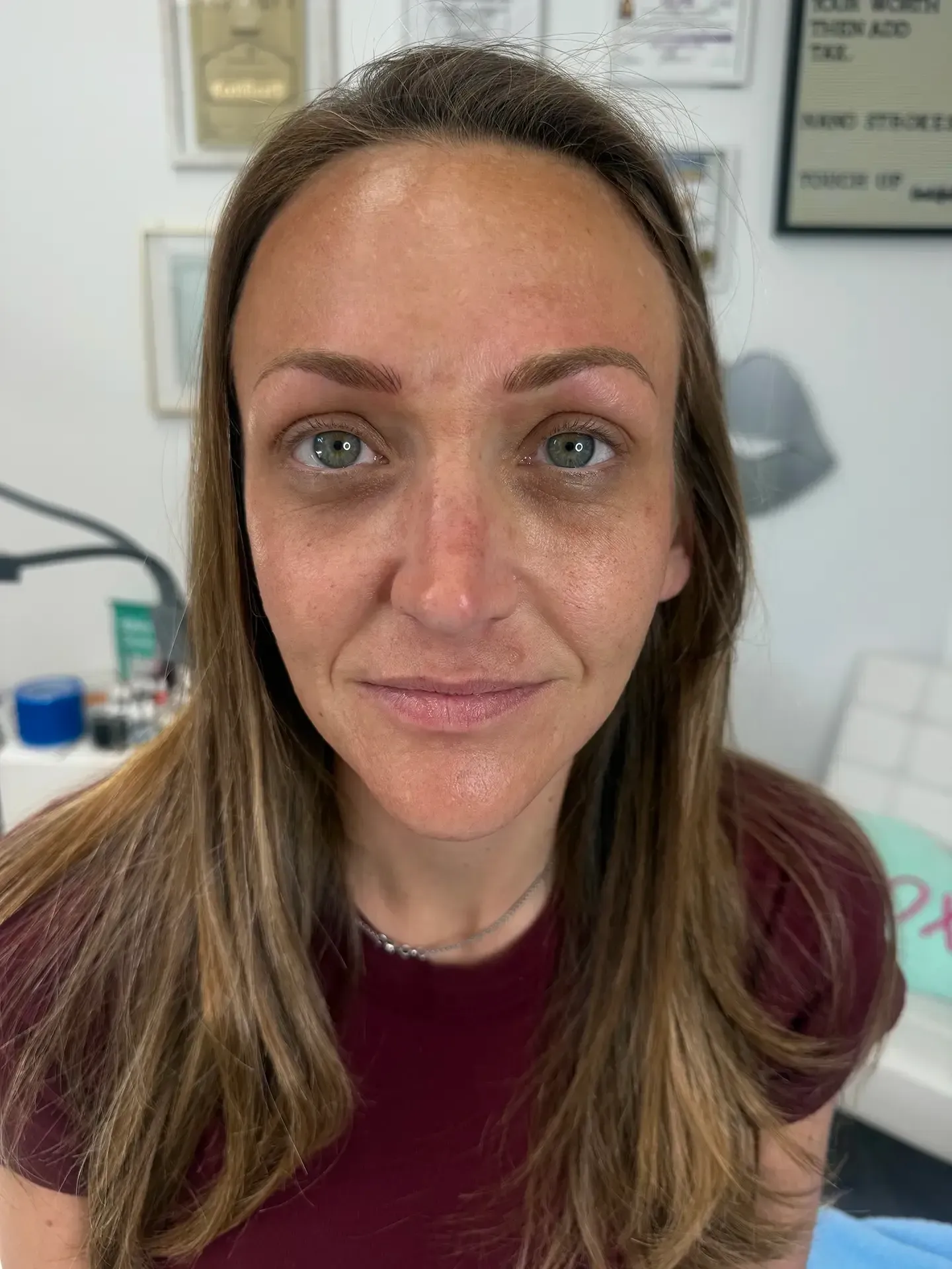 A woman with fair skin and light brown hair in a clinic setting. She's looking at the camera with a neutral expression.