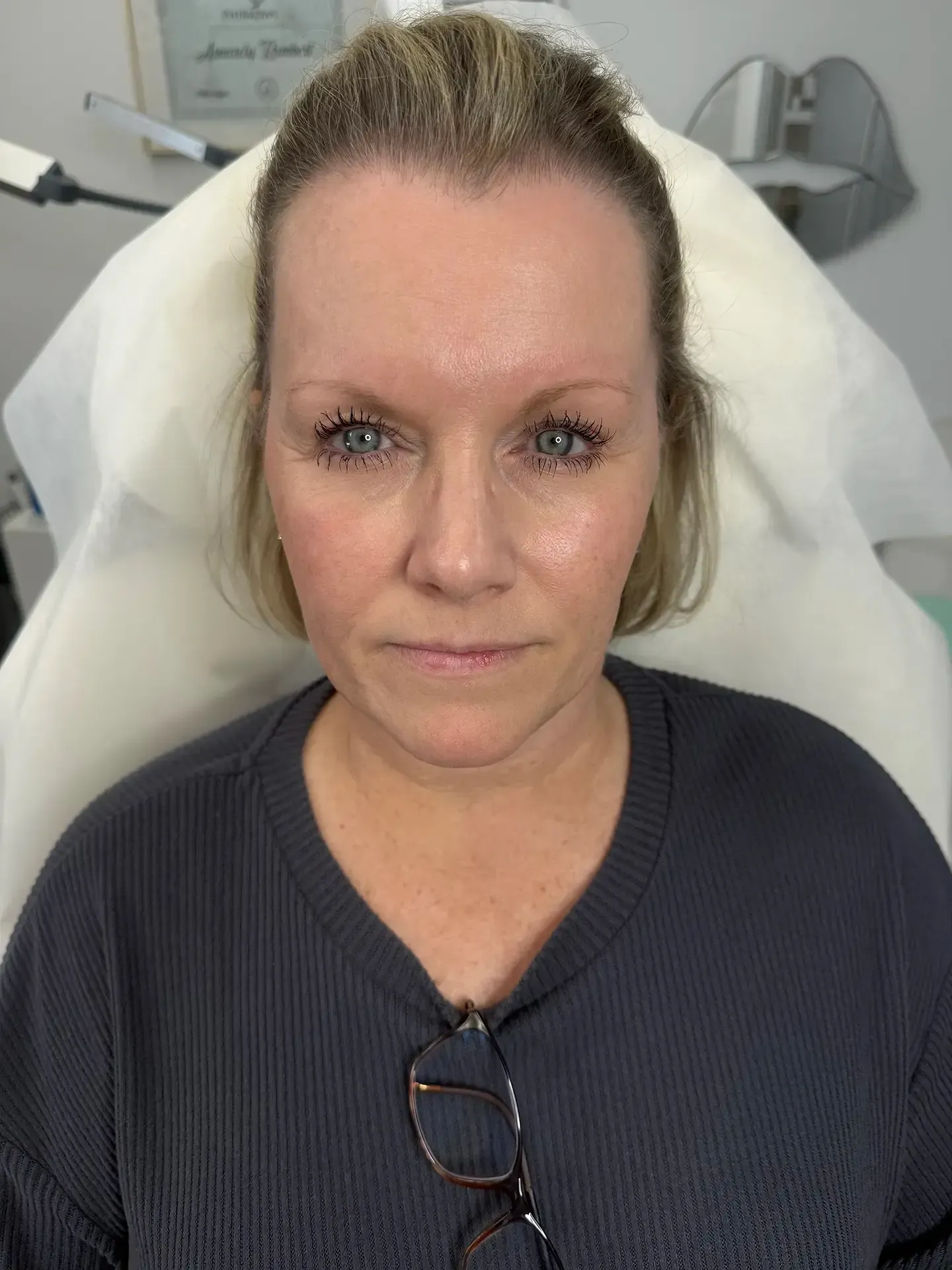 Woman with light skin, wearing a gray sweater, sitting in a medical chair, with short blonde hair, and glasses on her chest.