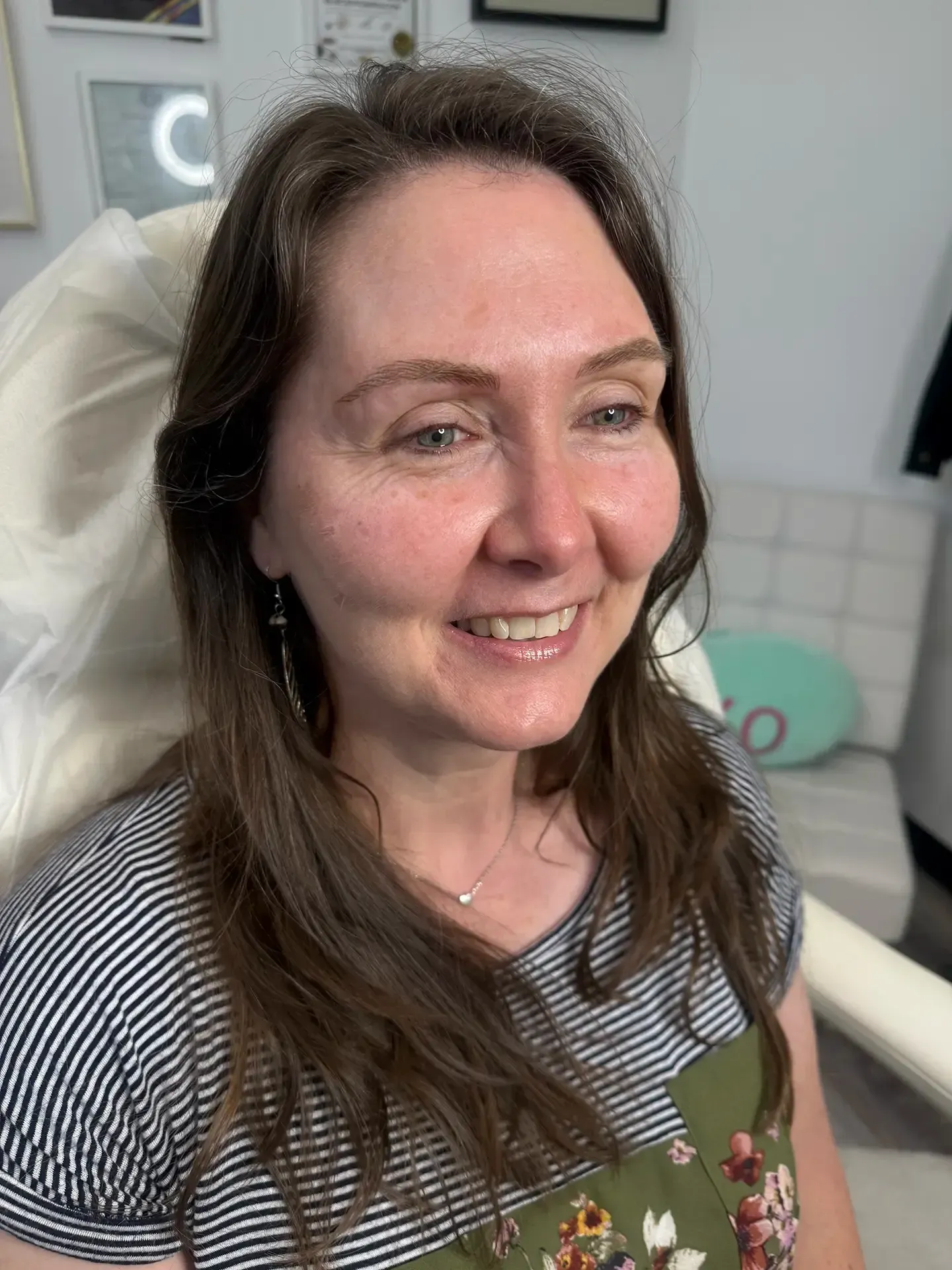 Woman with brown hair and eyebrows smiles, wearing a striped top, sitting in a chair in a clinic setting.