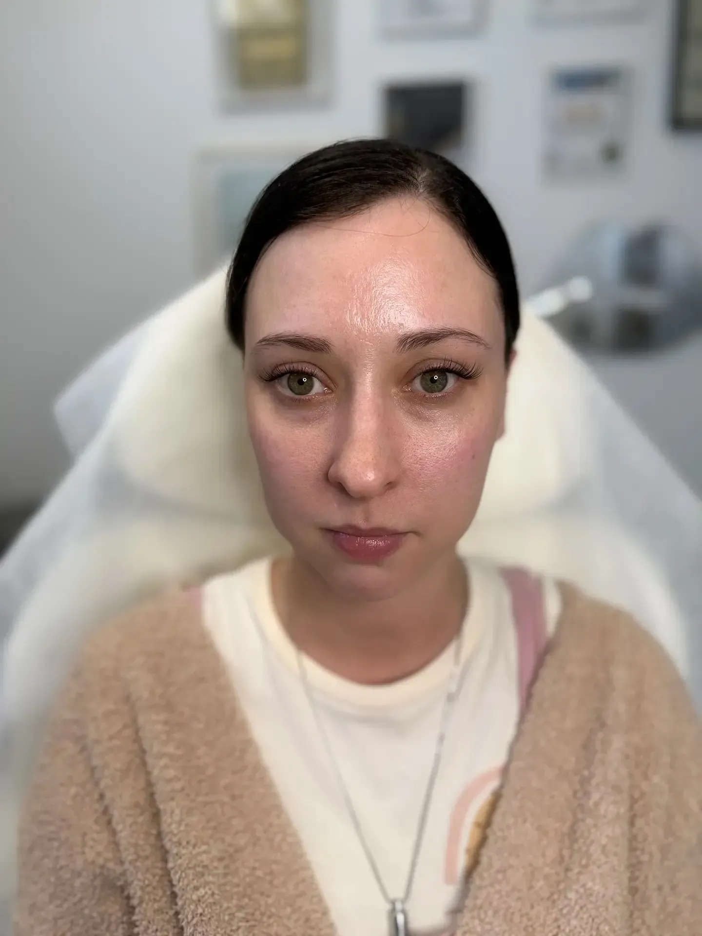 Woman with light skin looking at the camera. She is seated indoors, appearing to be in a medical or cosmetic setting.
