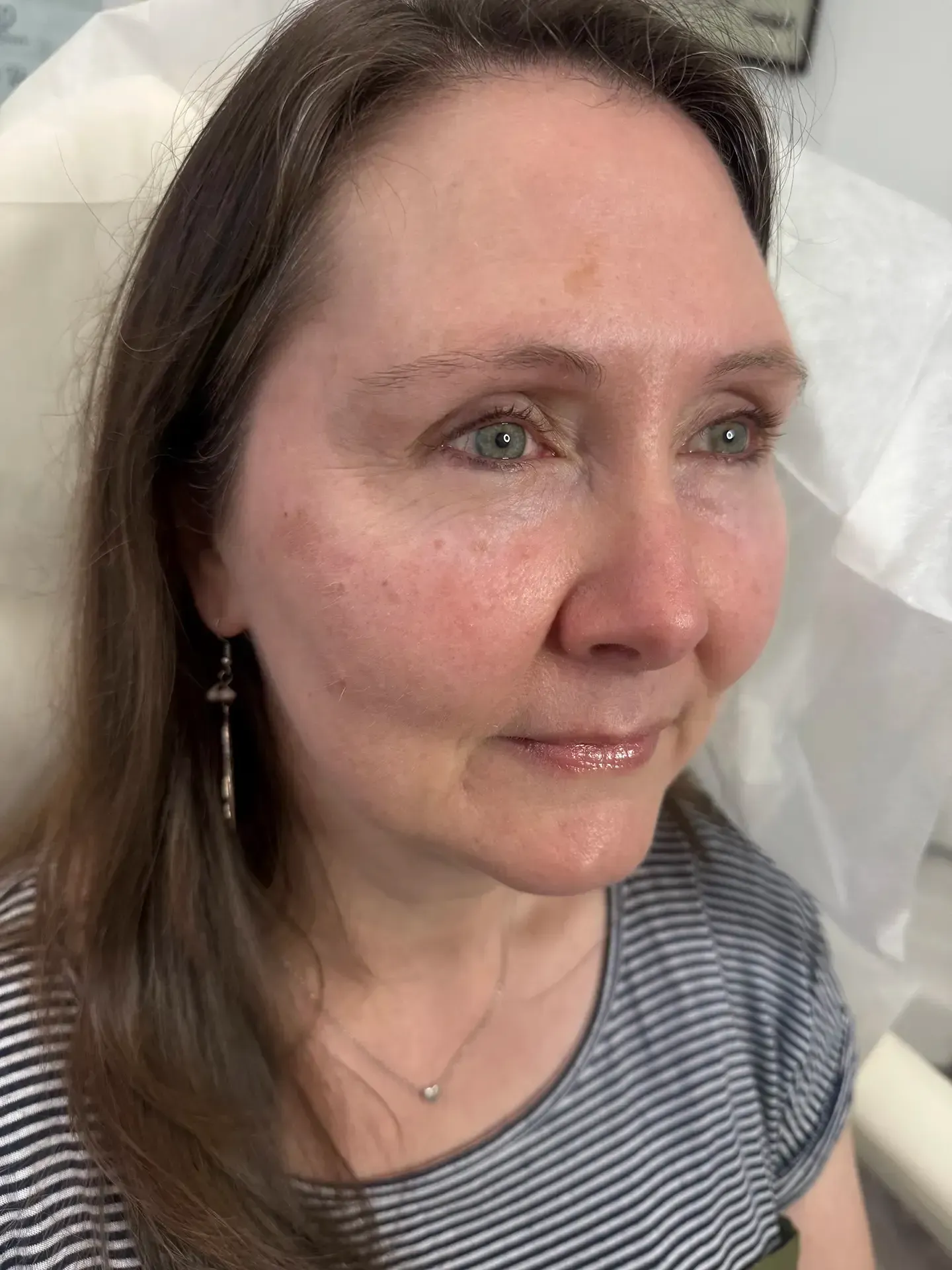 Woman with fair skin, light eyes, and brown hair, wearing a striped shirt, smiling slightly.