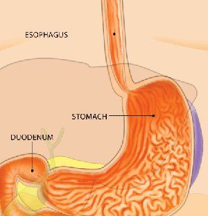 Gastrostomy — Esophagus, Stomach And Duodenum Chart in Louisville, KY