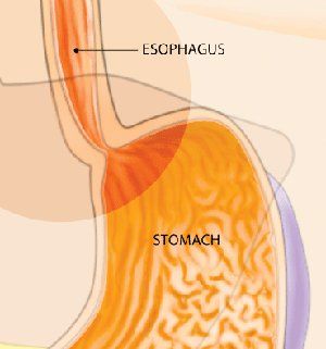 Gastrostomy — Zoom In Of Esophagus And Stomach Diagram in Louisville, KY