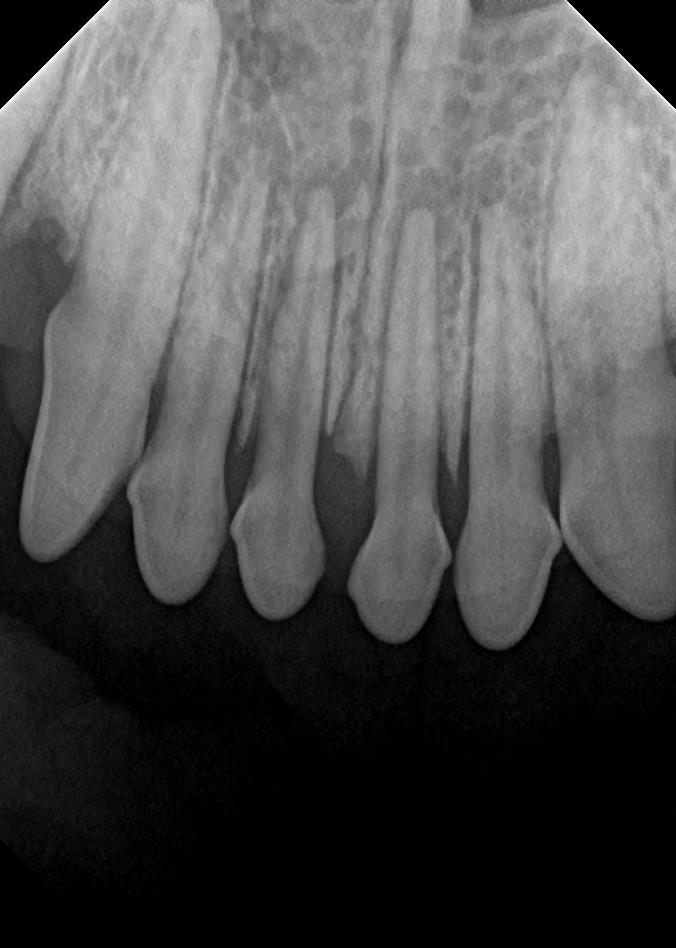 Healthy Canine Teeth in Bottom Jaw