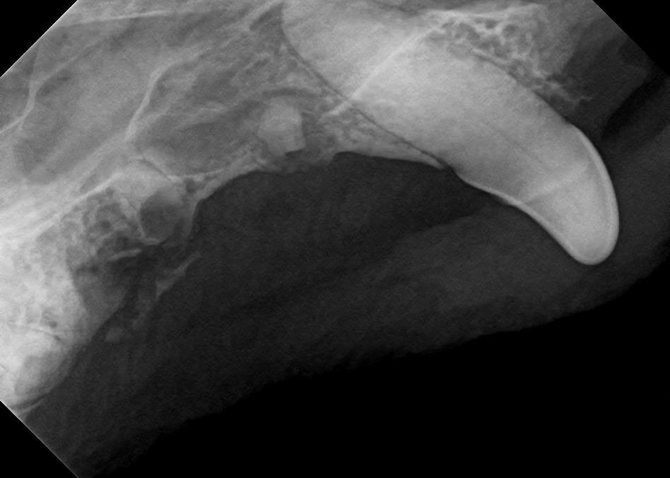 Canine Tooth Below the Gum X-Ray