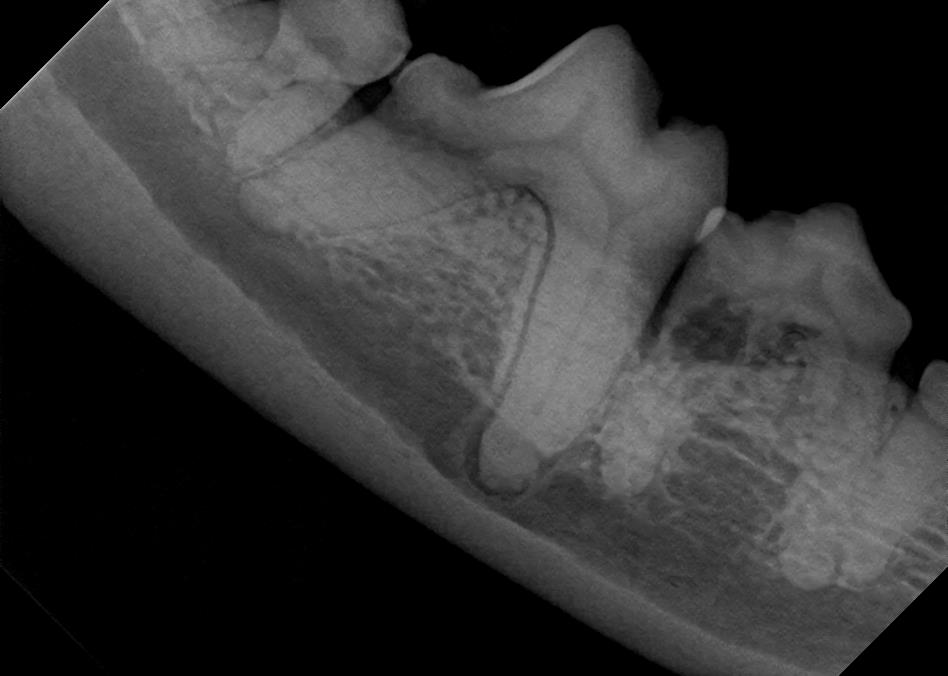 Cavity & Ligament Loss in Canine X-Ray