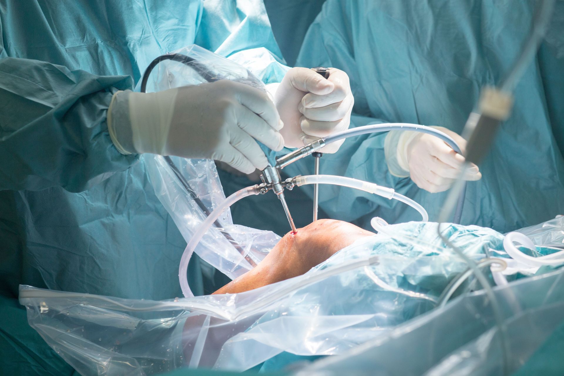 Artroscopia do joelho