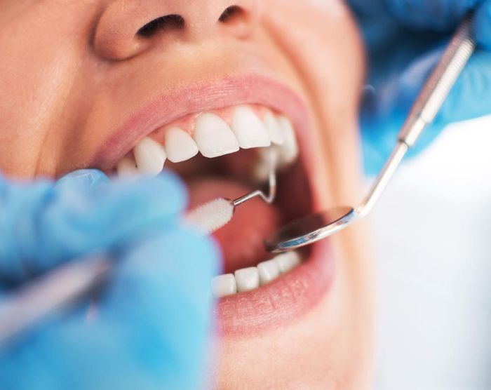 Dental Procedure — Alameda, CA — Alameda Family Dental Practice