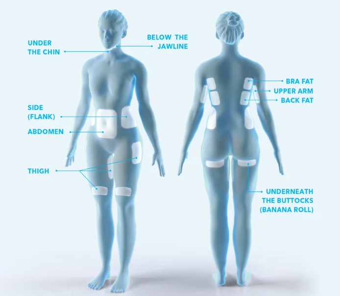 A diagram of a woman 's body showing where she has stickers on her body.