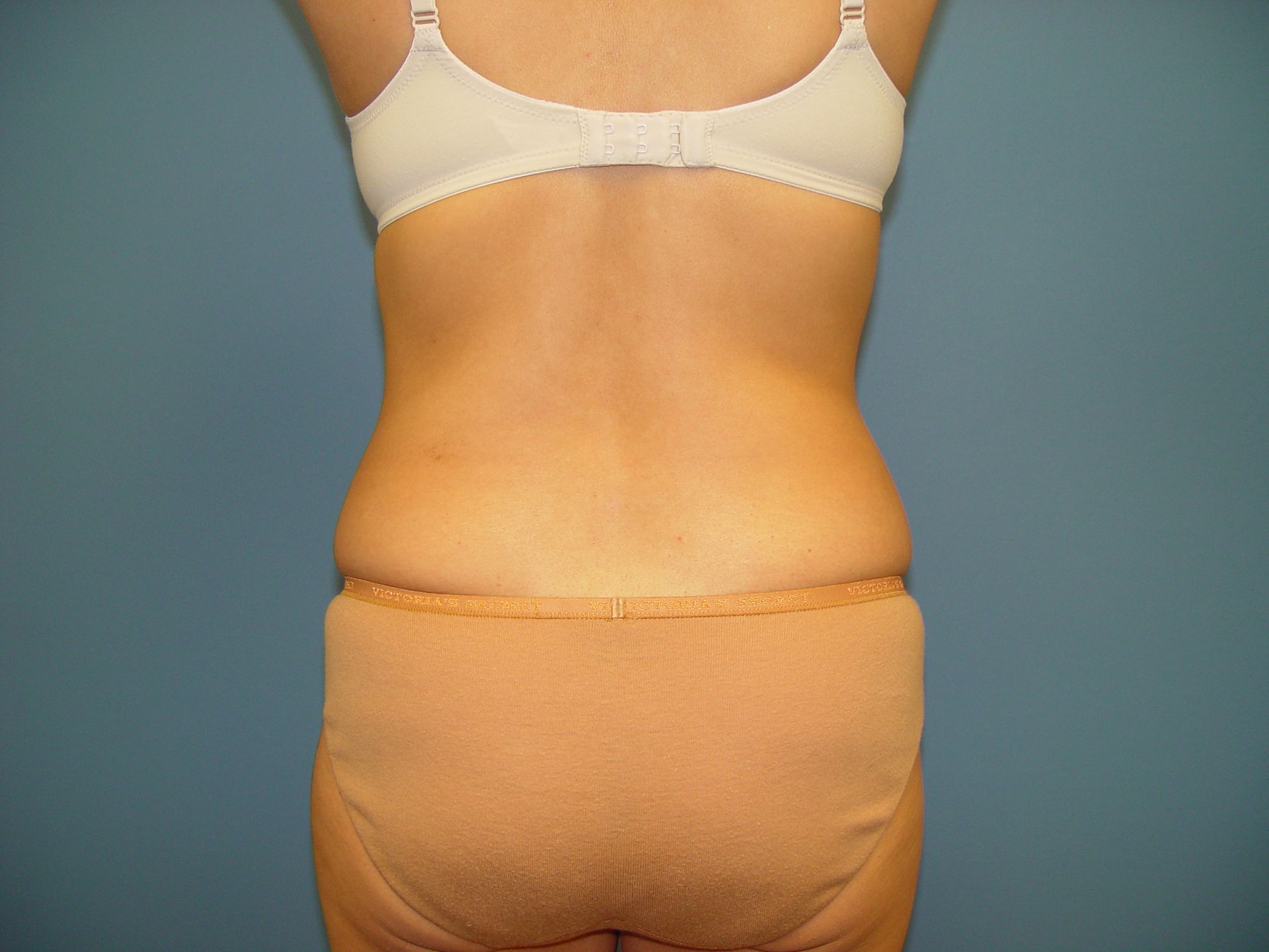 The back of a woman wearing a bra and underwear