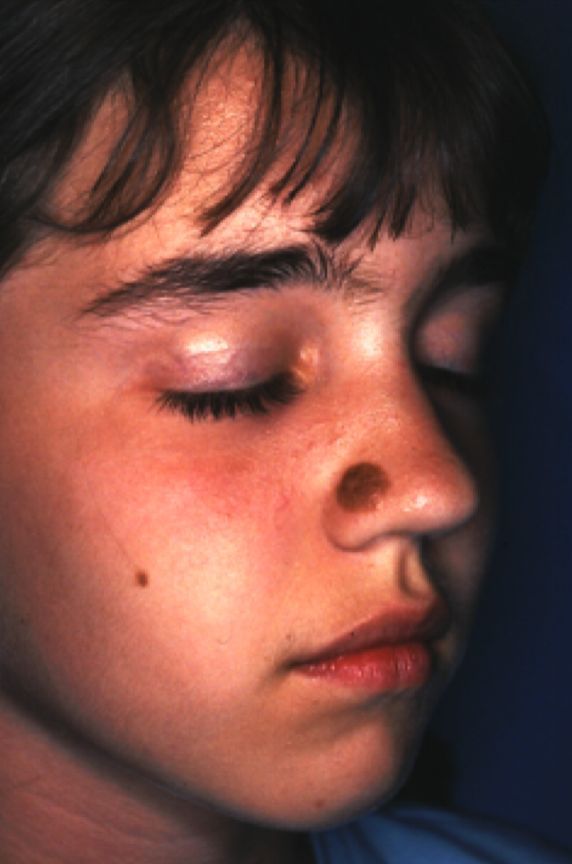 A close up of a person 's face with their eyes closed