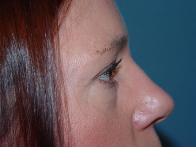 A close up of a woman 's face with a blue background.