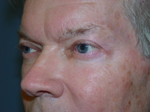 A close up of a man 's face with blue eyes.