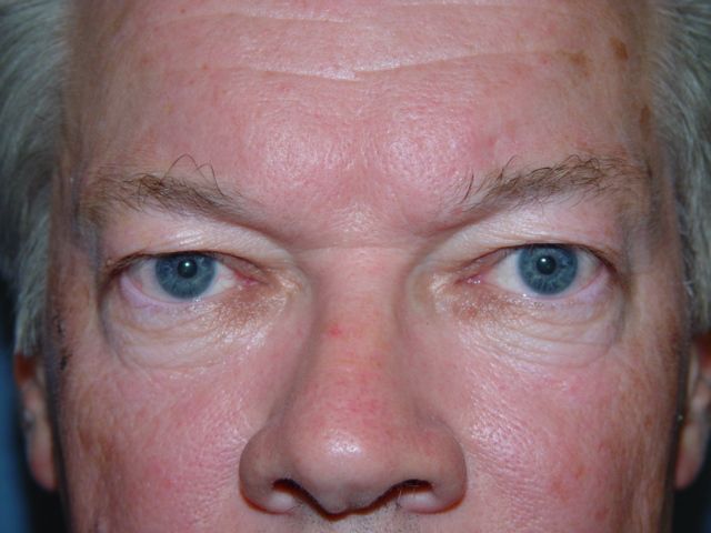 A close up of a man 's face with blue eyes.