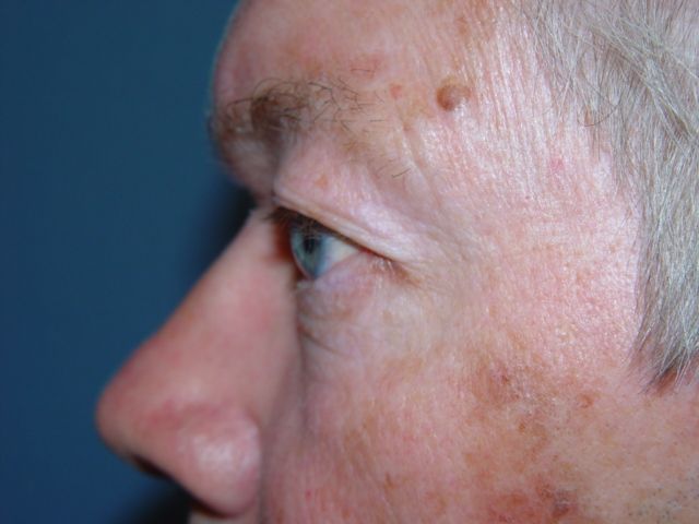 A close up of a man 's face with a blue eye.