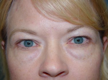 A close up of a woman 's face with blue eyes.