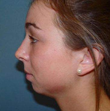 A close up of a woman 's face with pearl earrings.