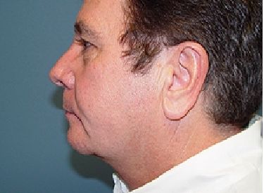 A close up of a man 's face and neck.