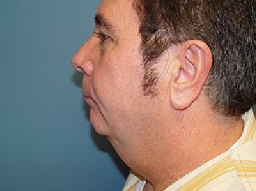 A close up of a man 's neck and ear.