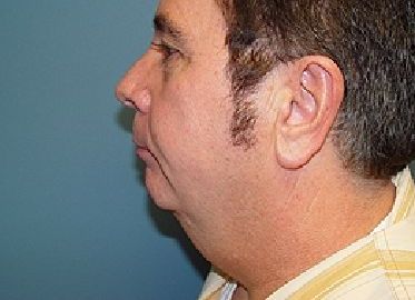 A close up of a man 's neck and ear.