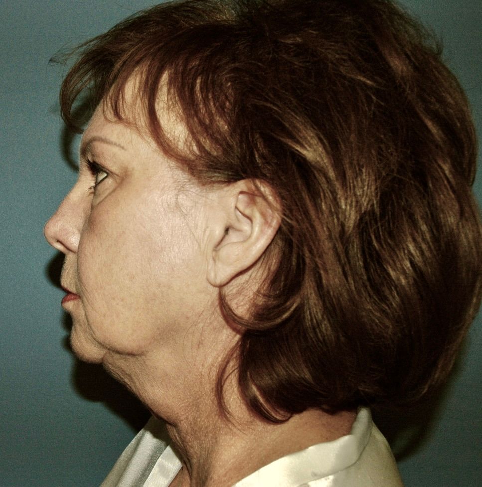 A woman with brown hair is wearing a white shirt