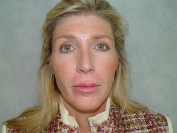 A woman with blonde hair and green eyes is looking at the camera.