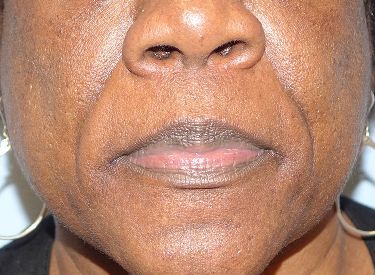 A close up of a woman 's face with wrinkles and earrings.