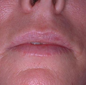 A close up of a woman 's mouth and nose.