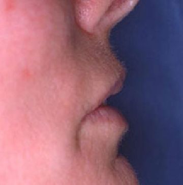 A close up of a person 's face with a blue background.