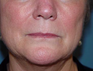 A close up of a woman 's face with a red nose.