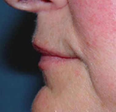 A close up of a person 's face with their mouth open.