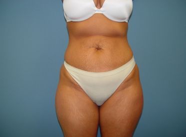 A woman in a white bra and white underwear is standing in front of a blue wall.