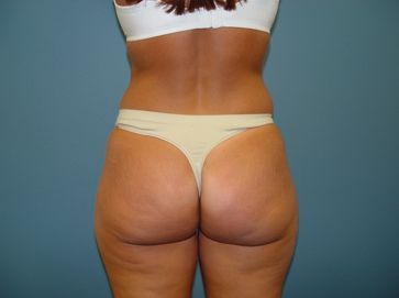 The back of a woman wearing thong underwear and a white bra.