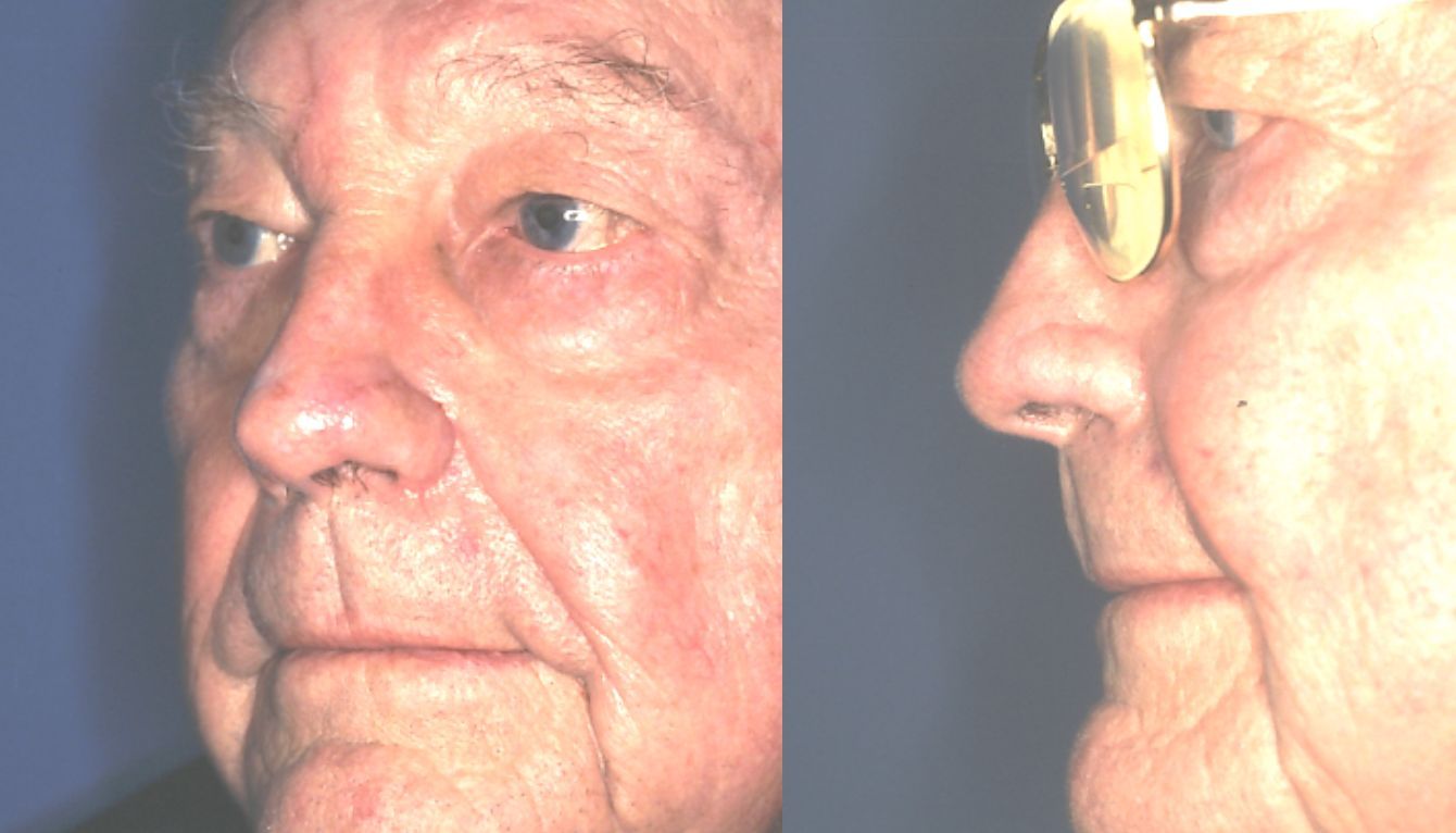 A close up of a man 's face with glasses and a nose ring.