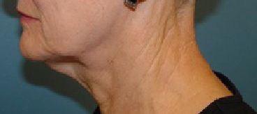 A close up of a woman 's neck and face.