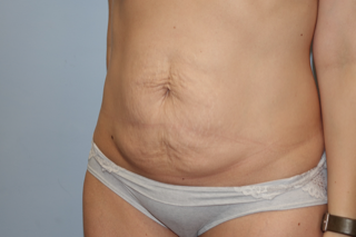 A woman in white underwear is showing her stomach.