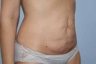 A woman without a shirt is standing in front of a blue wall.