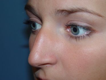 A close up of a woman 's nose and eyes.