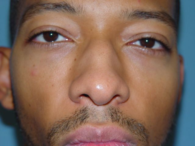 A close up of a man 's face with a beard.