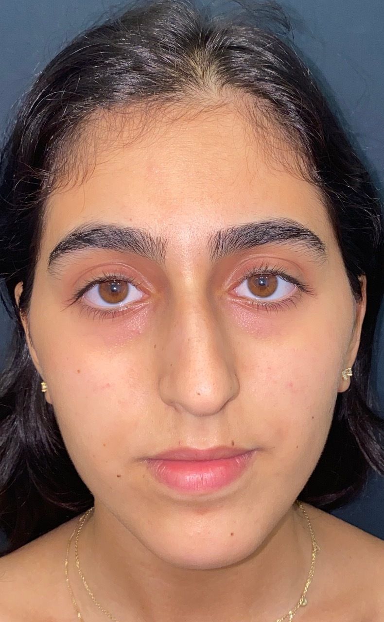 A close up of a woman 's face without makeup.