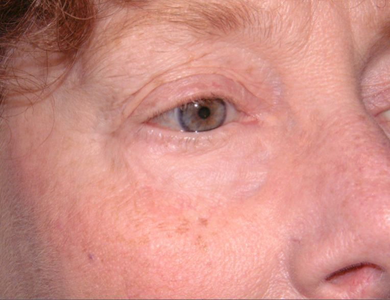 A close up of a woman 's eye and nose