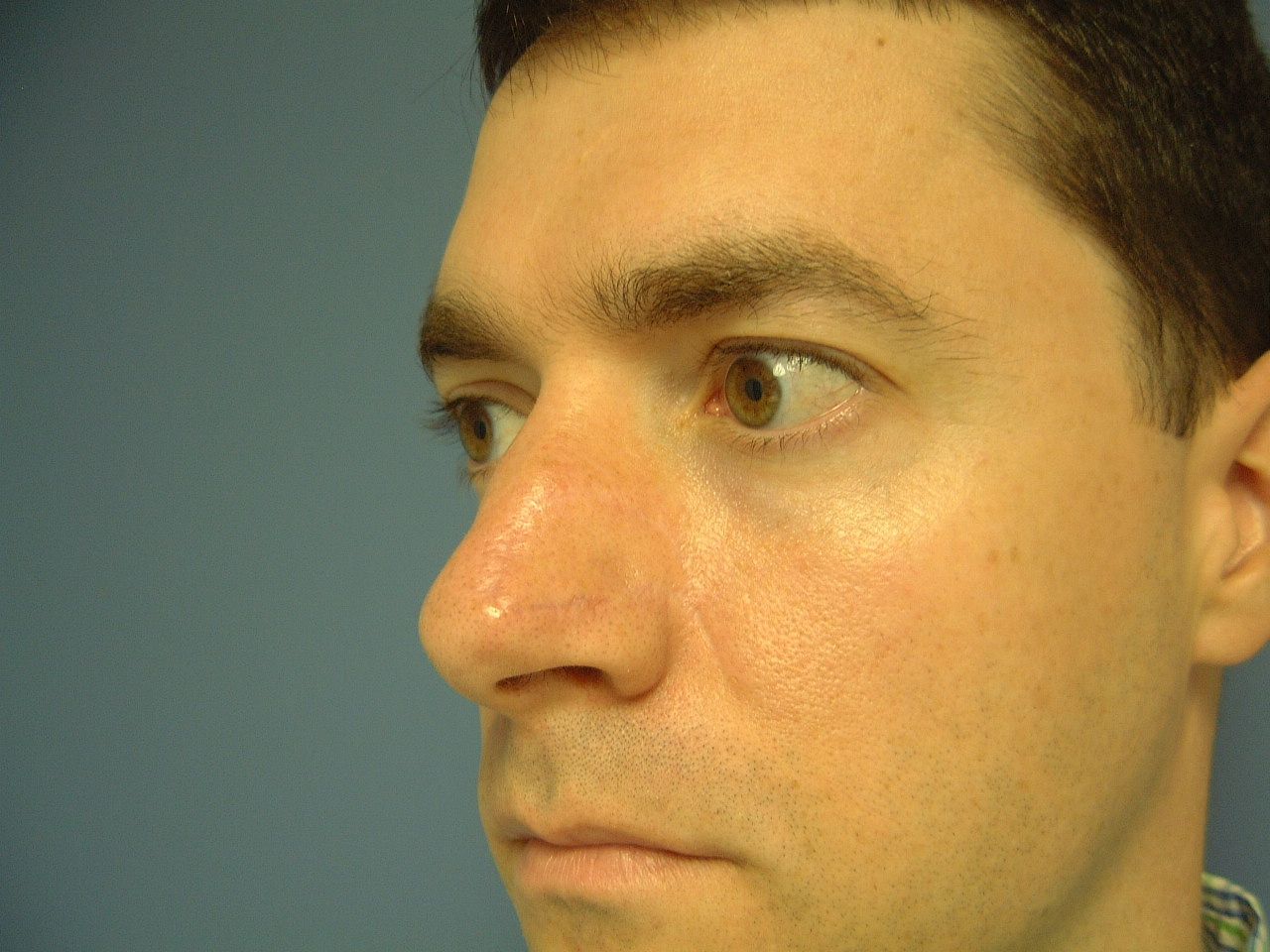 A close up of a man 's face with a red nose.
