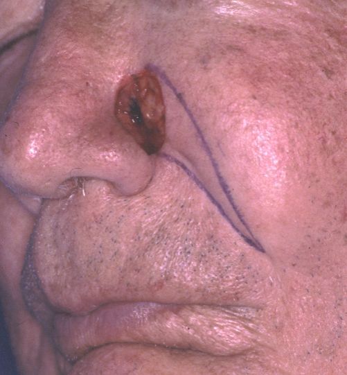 A close up of a person 's face with a drawing on it.