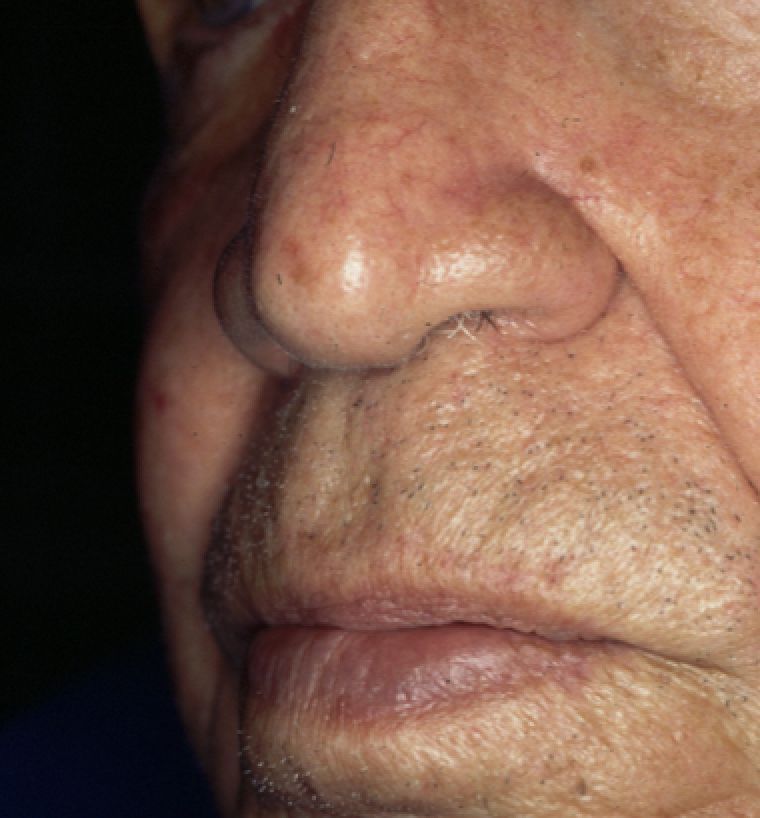 A close up of an older man 's nose and mouth.